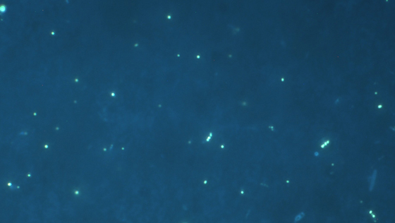 DAPI stained bacteria on a membrane filter from samples taken from a fish farm in New Brunswick