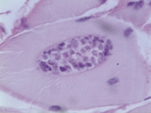 Plasmodia of Kudoa thrysites within the muscle