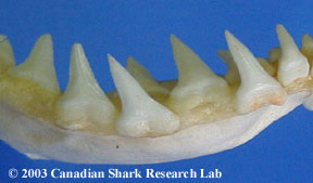 Figure 3 : Blue shark teeth, lower set.