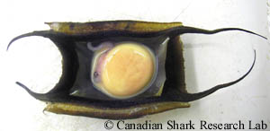 Capsule d'œuf de raie épineuse (Amblyraja radiata), avec une paroi ouverte afin de révéler l'embryon en développement.