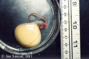 A winter skate (Leucoraja ocellata) embryo removed from its egg capsule. Note the external gill filaments and the large external yolk sac.